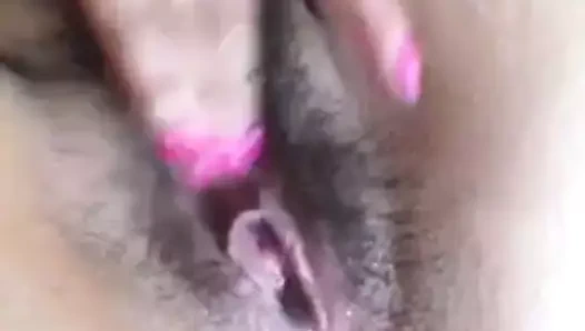 kıllı fışkırtma