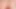 Anal de 4