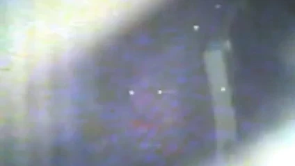 Zhangjiajing hemşireler hizmetçi yapay penis Tayvan Tayvanlı hemşireler(13