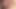 Bg anal 4