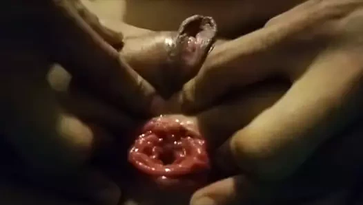 18 yaşındaki ilk anal prolapsus girişimi