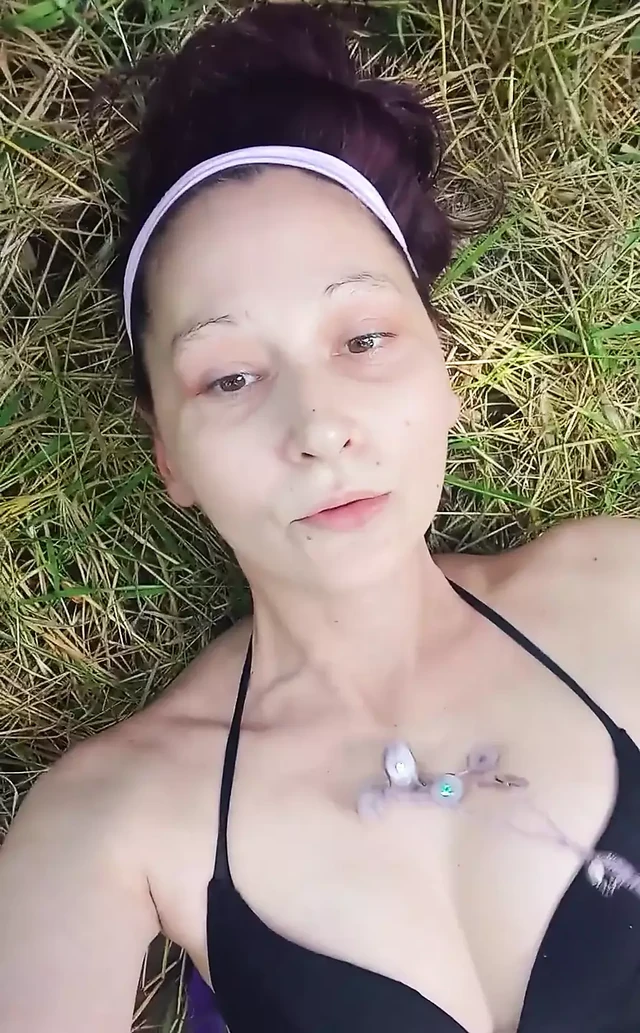 Something Bit My Ass and Tits