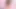 Laynee James sonsuz orgazmdan epileptik oluyor