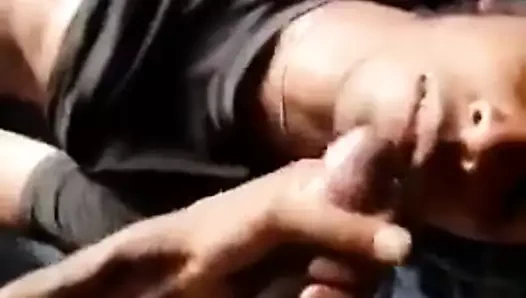 Yüzündeki fındık