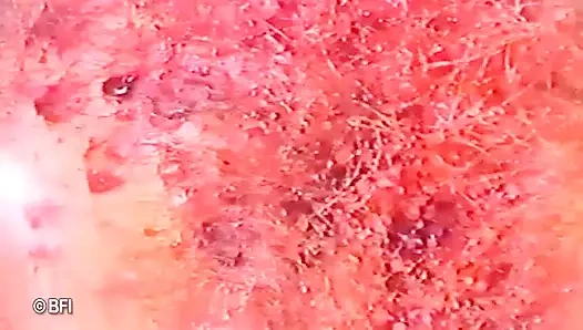 Piliç cezalandırıcısından domine ediliyor