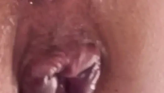 Aşırı anal vakum pompası eğitimi 2025