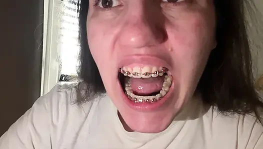 Dilinizle diş teli yalamak