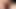 Akıntı ile tedavi edilen penis ve glans