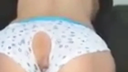 anal1