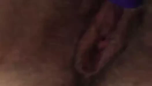 Kıllı kedi ile büyük labia