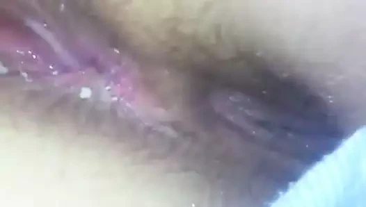 Kirli pislik yayılma