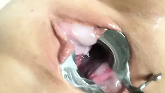 Kedi spekulum tarafından açıldı