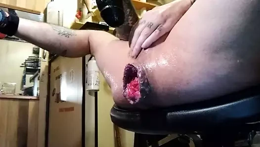 göt deliğimi yok etmek