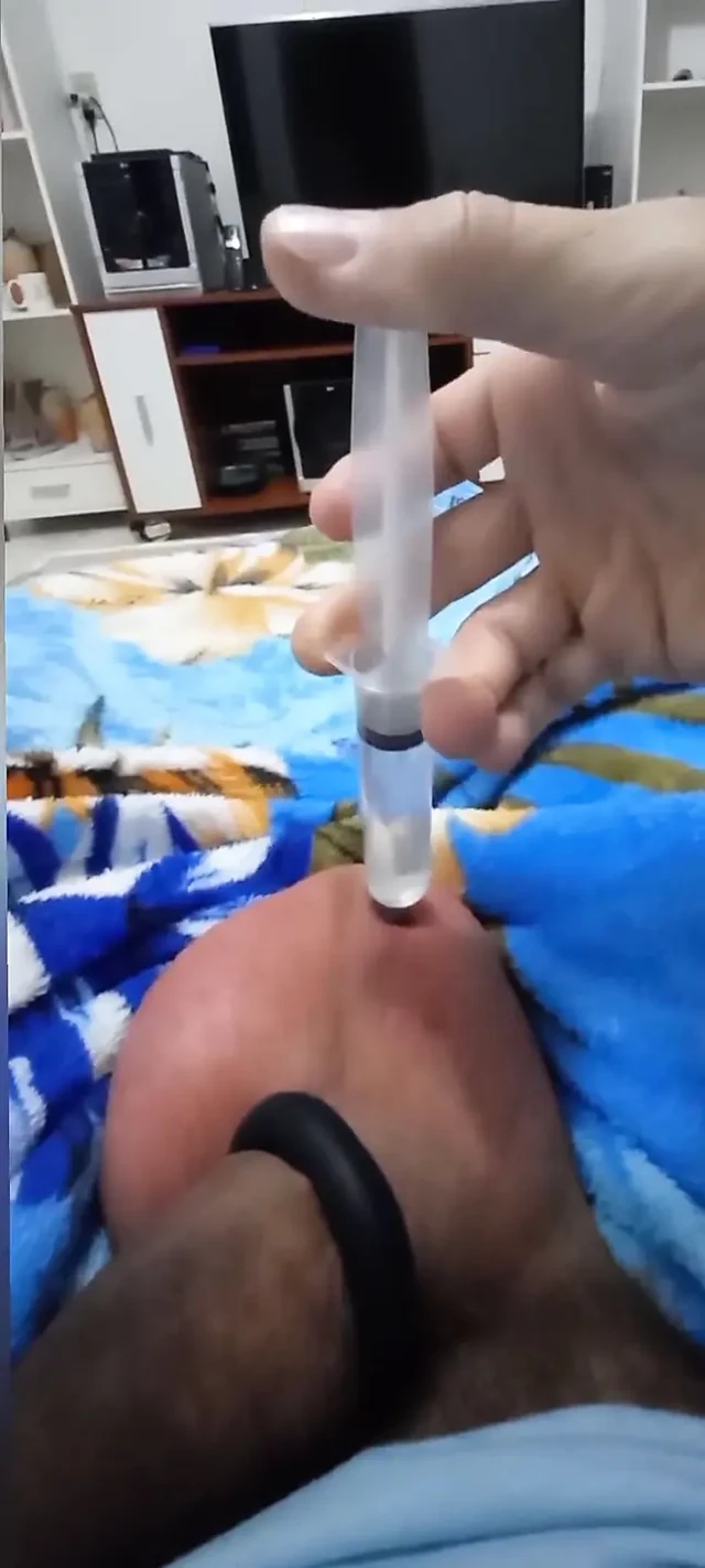 Her yumurtaya 60cc salin enjeksiyonu