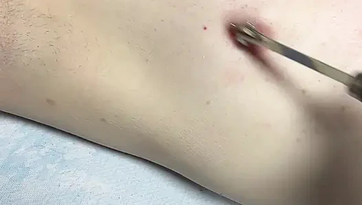 Duyusal Yoksunluk Bölüm 1