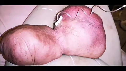 Yine glukozla dolduruluyor, bölüm 1