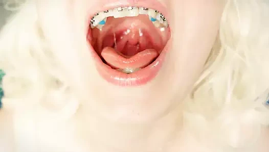 Diş teli fetişi - mukbang yemenin asmr videosu... yemek fetişi.