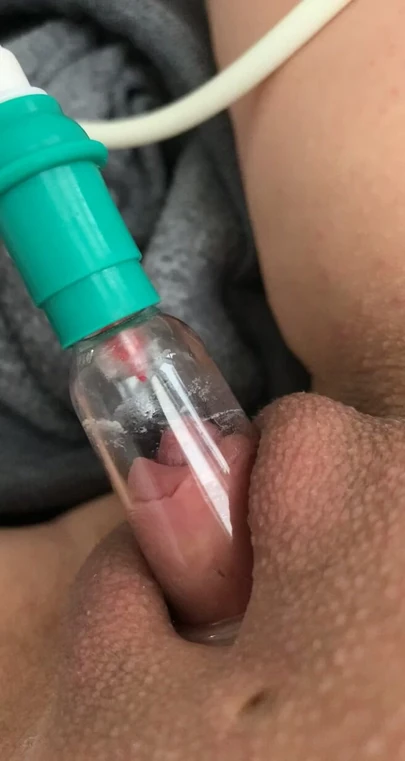 Накачка клитора