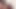 Penis tıkacı ile mikro bekaret kafesini serbest bırakıyor