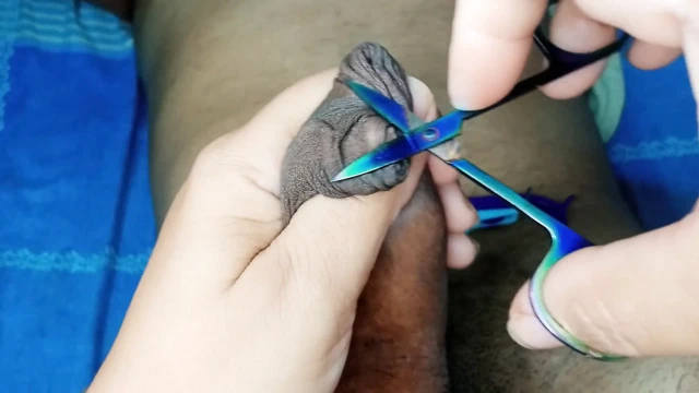 En iyi sünnet derisi sünnet rol yapma mastürbasyonu