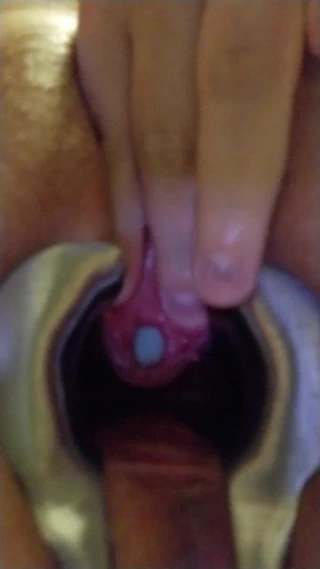 İdrar deliğinden çıkan üretral ses