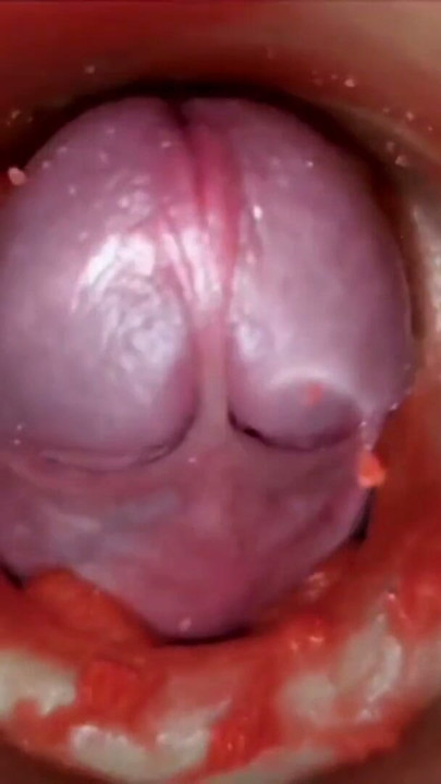 Cumfeti Damlayan Creampie Derlemesi - Endoskopi Görünümü | Bölüm 1