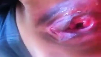 Etli kedi dudaklar dik hemşire o ben sikme