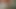 Taze sünnet ereksiyon