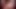 Pmc'nin showmeurtits derlemesi-01