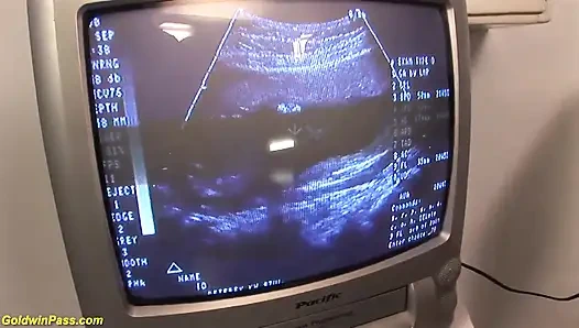 Kızıl saçlı hamile klinikte sikiliyor