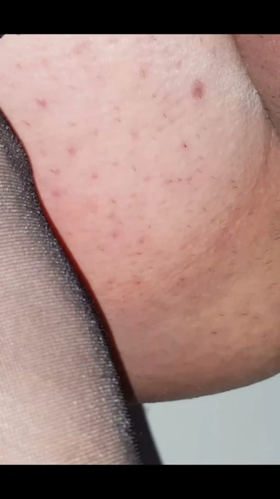Dani Leg Siyah Çoraplarla | Bölüm 1
