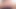 Brett rossi kontrolsüzce boşalıyor