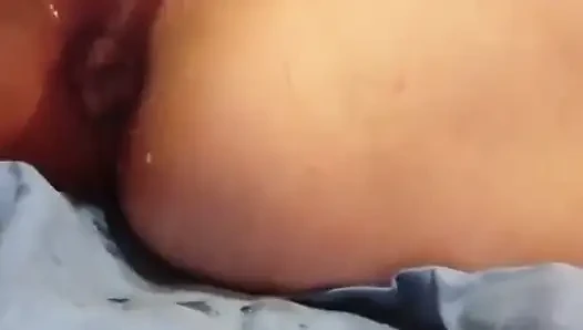 Anal Ve Fışkırma Ile