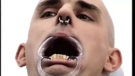 Diş hekimi sandalyesinde mahsur kaldı