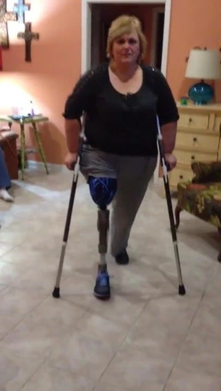 Büyük güzel kalça ampute