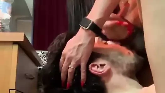 Yüzündeki fındık