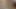 8 inçlik yarak gerçekten acıtıyor, 2 kız çok geç kaldı. Cumshot