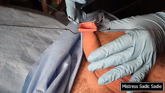 İğneler BDT'nin en iyi hali!