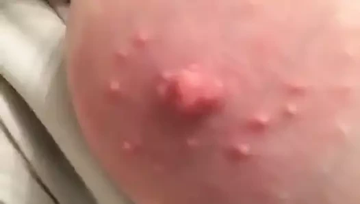 Benim gfs dev memeler ve meme uçları