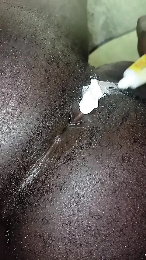 Göt çizikler aldı ve parçaladı.