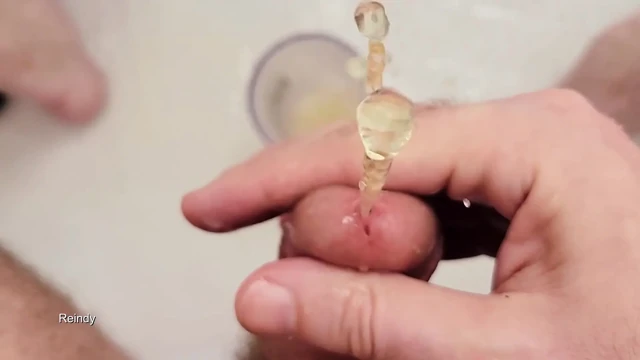 Çiş deliğimden epik boşalma ve sidik çeşmeleri.