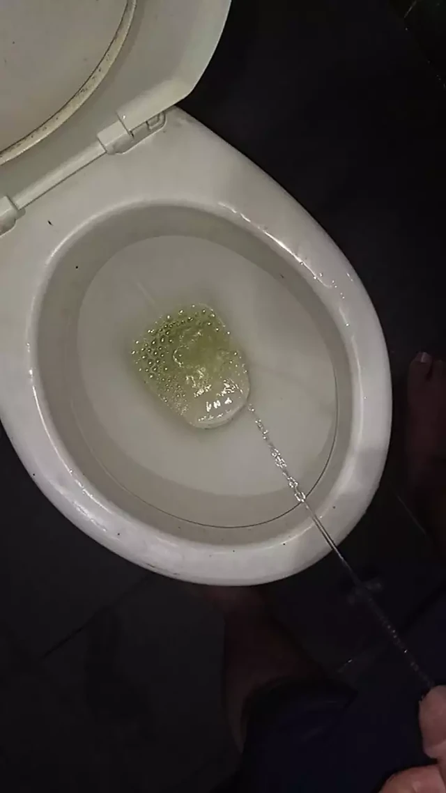 Писсинг в туалете с катетером на пенисе