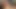 Schnellspritzer: Quicky 3