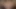 Orta yaşlı seksi kadın rahim ağzını sarktıyor