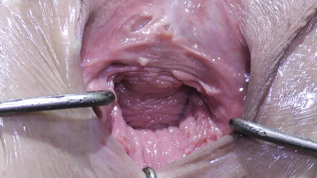 Далекий Зияющий