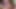 Beverly hills teaser 10