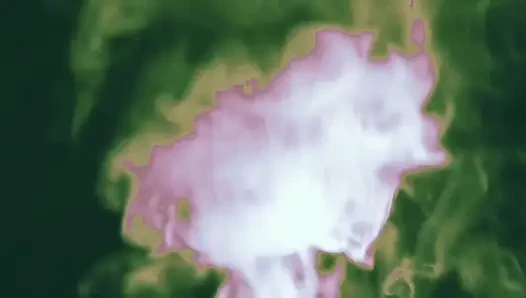 Bekaret inhalanları anal