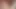 anal 2