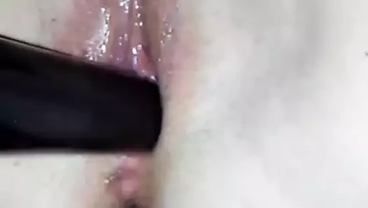 anal