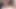Rüya travesti - ts hemşireler küçücük bir adam derleme 1 hakim